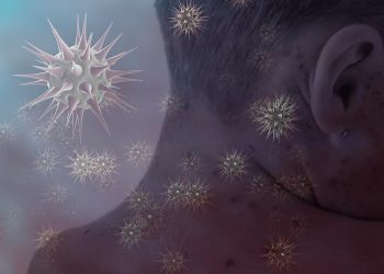 Nijerya'da kızamık salgını: 19 çocuk hayatını kaybetti