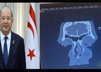 Dinçyürek:Cengiz Topel Hastanesi’nde tomografi cihazı hizmete alındı ve ilk tomografi çekildi