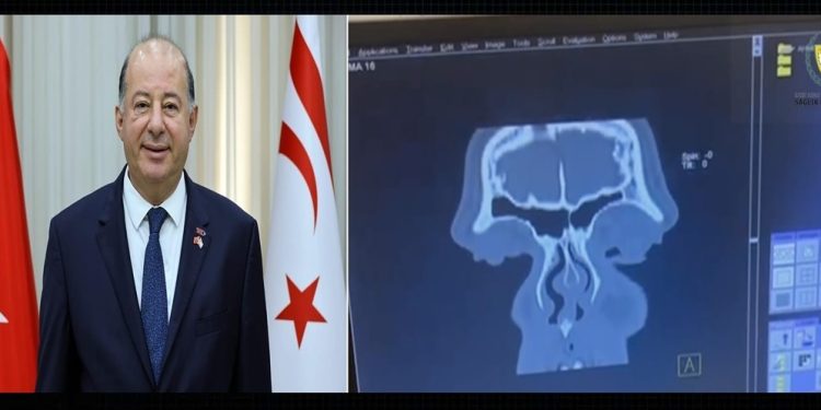 Dinçyürek:Cengiz Topel Hastanesi’nde tomografi cihazı hizmete alındı ve ilk tomografi çekildi