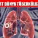 Sağlık Bakanlığı’ndan Dünya Tüberküloz Günü açıklaması