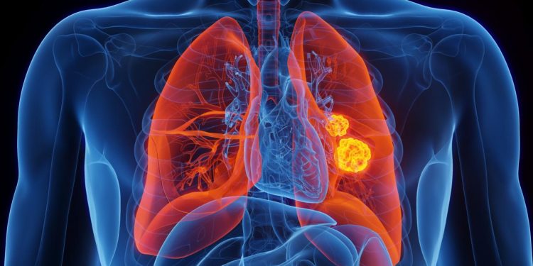 Süper aşı, kanserin yayılmasını tamamen durdurabilir