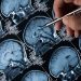 Alzheimer ve kanser, yakında duyamadığımız seslerle tedavi edilebilir