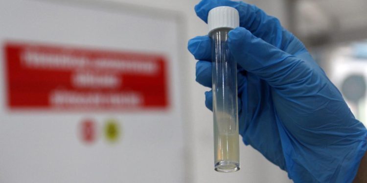 Dünyanın en ölümcül bulaşıcı hastalığı geçen yıl 1,23 milyon can aldı