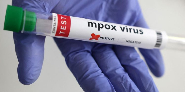 Maymun çiçeği virüsünün yeni bir türü tespit edildi