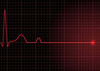 Ali Kumlutepe’nin ölüm sebebi “kalp damar hastalığı”