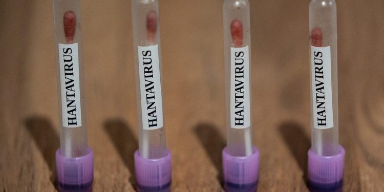 ABC: ABD, hantavirüs vakalarını “3. seviye acil durum” koduyla takibe aldı