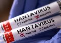 Yolcu gemisi MV Hondius’ta 5 hantavirüs vakası doğrulandı