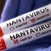 Yolcu gemisi MV Hondius’ta 5 hantavirüs vakası doğrulandı