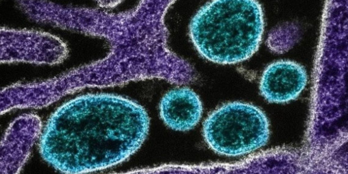ABD’de 60 yıl sonra bir hayvanda et yiyen parazit görüldü