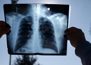 İspanya 114 yıl sonra ülkede ilk kez gözlemlenecek tam güneş tutulmasına hazırlanıyor