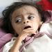 BM’den Yemen’de insani kriz uyarısı